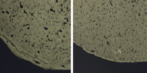 Cross section of femur from 24 and 77 year-olds shows osteoporosis