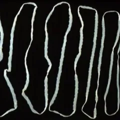 White, segmented tapeworm on a black background, wound back and forth more than 10 times to fit on the rectangular screen