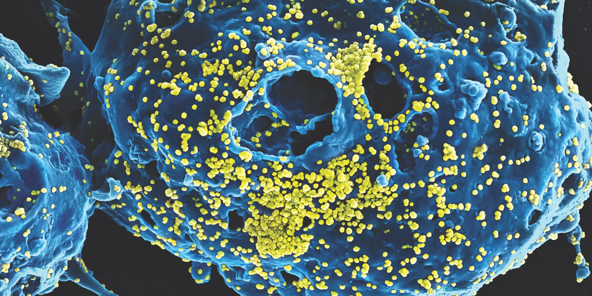 blue and yellow virus detail of Jiro Wada 