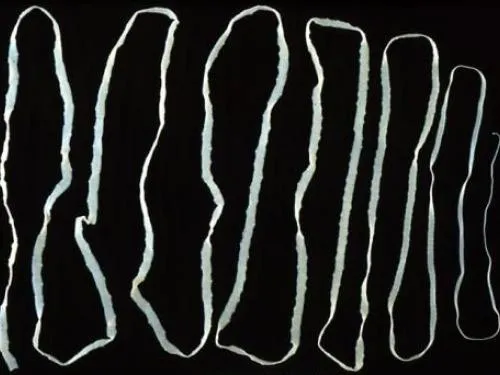 White, segmented tapeworm on a black background, wound back and forth more than 10 times to fit on the rectangular screen