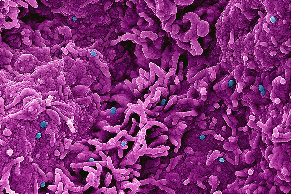 Scanning electron microscope view of small, light blue dots on a pink cell culture.