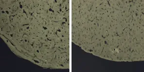 Cross section of femur from 24 and 77 year-olds shows osteoporosis