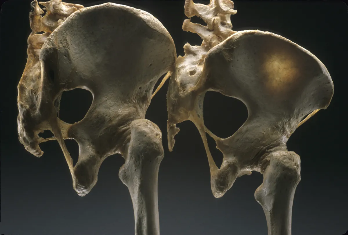 Male & female pelvi side by side, vertical with part of thigh and spine attache